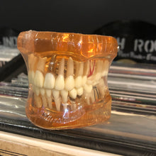 Load image into Gallery viewer, Disease Teeth Model
