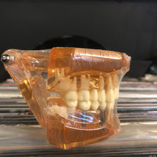 Load image into Gallery viewer, Disease Teeth Model
